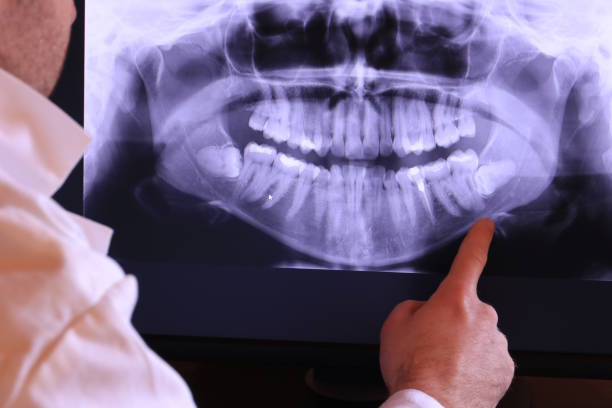 Best Urgent Dental Care for Toothache in Chebanse, IL