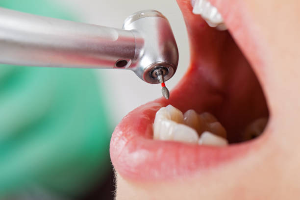 Best Emergency Dentist for Knocked-Out Tooth in Chebanse, IL